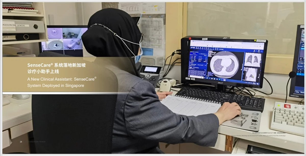 商湯AI肺癌篩查技術落地新加坡